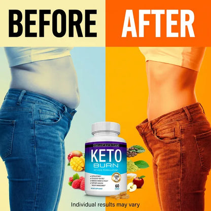Keto Burn Supplement