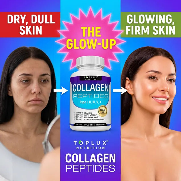 Collagen Peptides